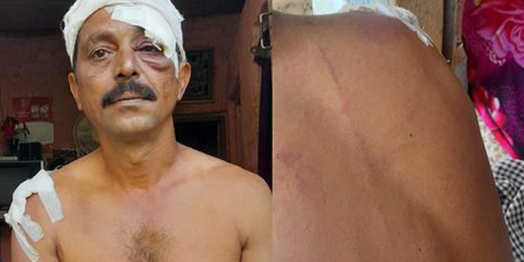 നെയ്യാറ്റിൻകരയിൽ വീണ്ടും ഗുണ്ടാ ആക്രമണം ; പിന്നിൽ ഡാൻസർ വിഷ്ണുവെന്ന് സൂചന