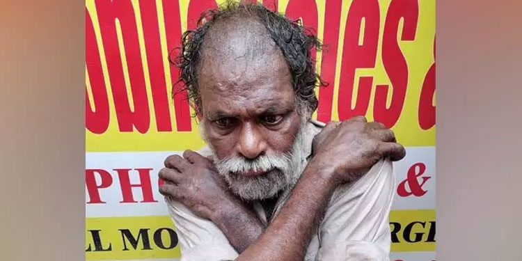 ഭിക്ഷയായി ഒരു രൂപ നൽകിയതിന് സ്ത്രീയെ ആക്രമിച്ചു ;  കത്രിക കൊണ്ട് കുത്തി