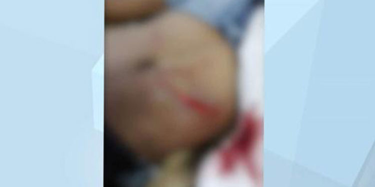 അമ്മയുമായി പിണങ്ങി, വയറാകെ കീറിമുറിച്ചു പിന്നാലെ വ്യാജപരാതിയുമായി യുവാവ് ; നുണ പൊളിച്ച് പോലീസ്