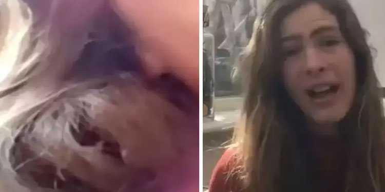 പക്ഷിക്കുഞ്ഞ് തന്‍റെ മുടിയിൽ കൂടുകൂട്ടിയെന്ന് യുവതി ; അതും 84 ദിവസം!