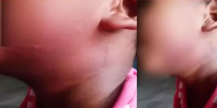 ‘ രാത്രിയില്‍ ഉറക്കെ കരയുന്നത് ശല്യം ’ ; പാലക്കാട്ട് ശിശുപരിചരണ കേന്ദ്രത്തിൽ കുട്ടികൾക്ക് മർദനം