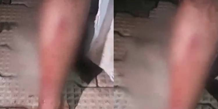 ബിൽ അടക്കാത്തതിനാൽ വൈദ്യുതി വിച്ഛേദിച്ചു ; കെഎസ്ഇബി ജീവനക്കാരന് മർദനം