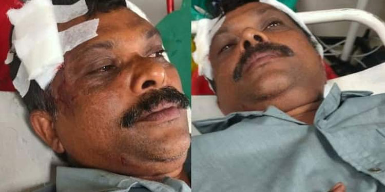 സിഗററ്റ് വലി ചോദ്യം ചെയ്തു : സ്കൂൾ വിദ്യാർത്ഥികളുടെ ആക്രമണത്തിൽ സിപിഎം നേതാവിന് പരിക്ക്