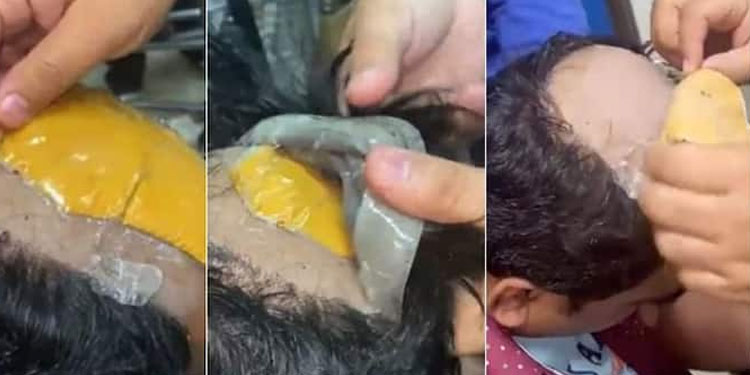 വിഗ്ഗിനടിയില്‍ 30 ലക്ഷത്തിന്റെ സ്വര്‍ണം ഒളിപ്പിച്ചു കടത്താന്‍ ശ്രമം ; യാത്രക്കാരന്‍ പിടിയില്‍