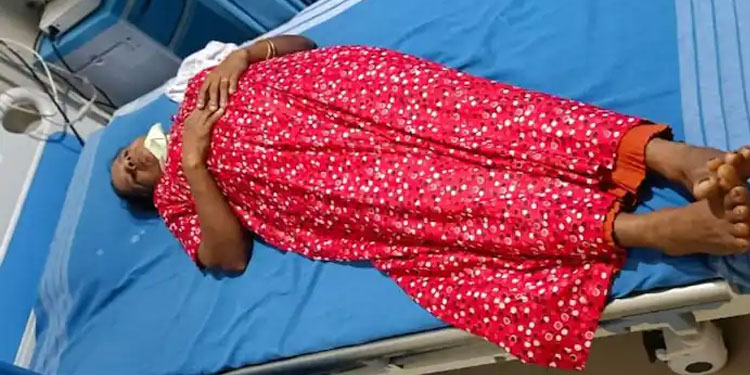 കാസർകോട് കാട്ടുപന്നിയുടെ ആക്രമണത്തിൽ വീട്ടമ്മയ്ക്ക് പരിക്ക്