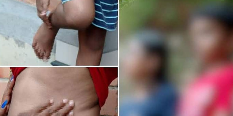 തിരുവനന്തപുരത്ത് പത്ത് വയസുകാരന് ക്രൂര മര്‍ദ്ദനം ;  ഡ്രൈവറെ അറസ്റ്റ് ചെയ്ത് ജാമ്യത്തിൽ വിട്ടു