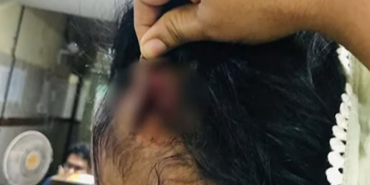 സ്‌ത്രീധന പീഡനം : കോഴിക്കോട്‌ ഭാര്യയേയും മകളേയും മർദിച്ച യുവാവിനെതിരെ കേസെടുത്തു