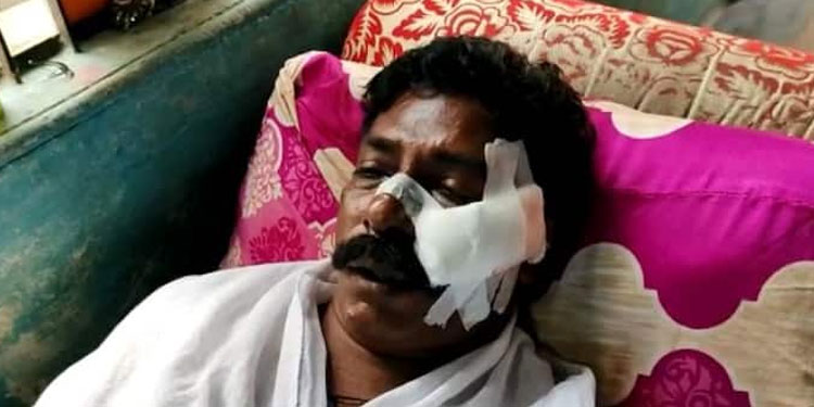 പരസ്യ മദ്യപാനം ചോദ്യം ചെയ്ത സിഐടിയു പ്രവർത്തകന് വെട്ടേറ്റു