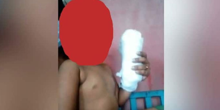 പിഞ്ചുകുഞ്ഞിന്റെ ശസ്ത്രക്രിയ വൈകിയ സംഭവം: അന്വേഷണ റിപ്പോര്‍ട്ട് തേടി മനുഷ്യാവകാശ കമ്മീഷൻ