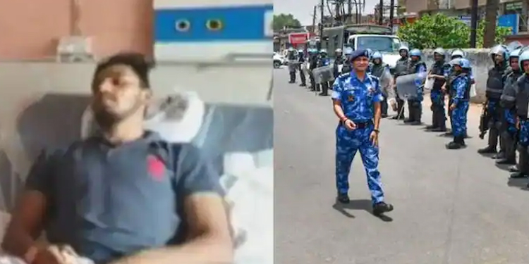 നുപുര്‍ ശര്‍മ്മയ്‌ക്കെതിരായ പ്രതിഷേധം; 6 തവണ വെടിയേറ്റ് യുവാവ് ; 2 വെടിയുണ്ടകൾ ഇനിയും പുറത്തെടുക്കാനായില്ല