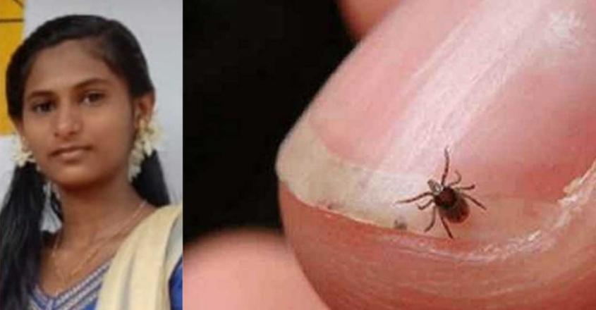 ചെള്ള് പനി ബാധിച്ച് പത്താം ക്ലാസ് വിദ്യാർഥിനി മരിച്ചു; പ്രതിരോധം ശക്തമാക്കുമെന്ന് മന്ത്രി