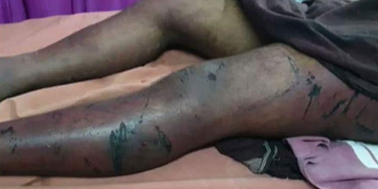 അട്ടപ്പാടിയിൽ 10 അംഗ സംഘത്തിന്‍റെ അടിയേറ്റ് ചികിത്സയിലായിരുന്ന കണ്ണൂർ സ്വദേശി വിനായകനും മരിച്ചു