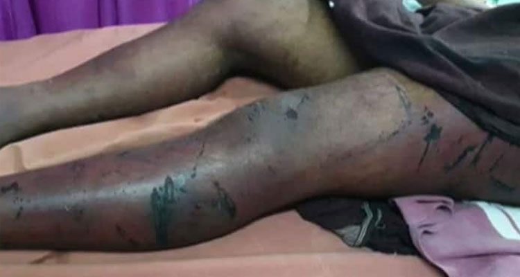 അട്ടപ്പാടിയിൽ 10 അംഗ സംഘത്തിന്‍റെ അടിയേറ്റ് ചികിത്സയിലായിരുന്ന കണ്ണൂർ സ്വദേശി വിനായകനും മരിച്ചു