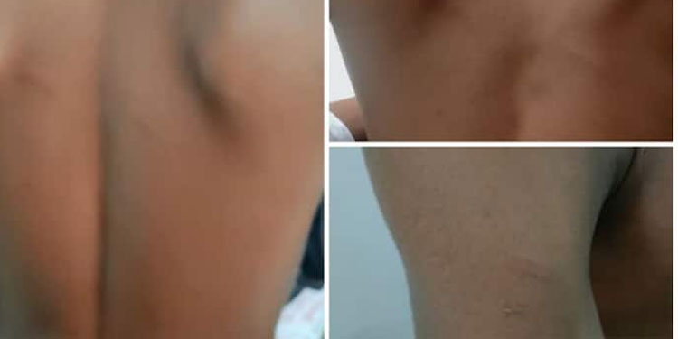 ഡെസ്കില്‍ താളമിട്ടു ; തൃശ്ശൂരില്‍ സർക്കാർ പ്രീമെട്രിക് ഹോസ്റ്റലിൽ ആദിവാസി ബാലന് മർദ്ദനം