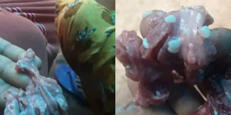 വയനാട്ടിൽ പുഴുവരിക്കുന്ന മാംസം പിടിച്ചു; ബീഫ് സ്റ്റാൾ അടപ്പിച്ച് അധികൃതർ
