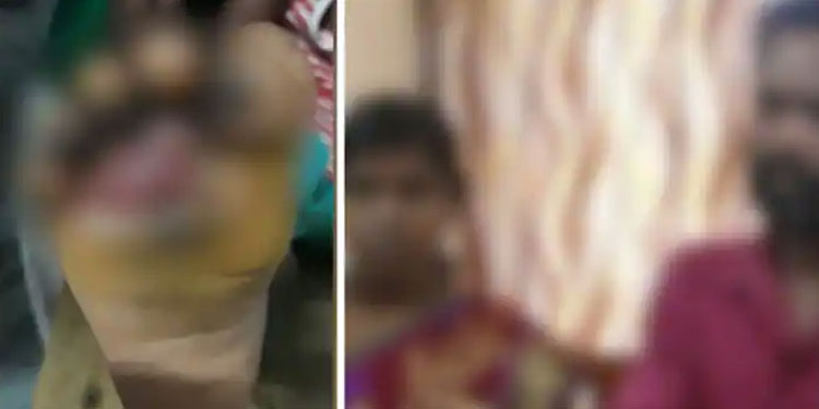 നാല് വയസുകാരന്റെ കാൽ സ്റ്റൌവിൽവെച്ച് പൊള്ളിച്ചു, ക്രൂരമർദ്ദനം; അമ്മയും ആൺസുഹൃത്തും പിടിയിൽ; കുട്ടി ചികിത്സയിൽ