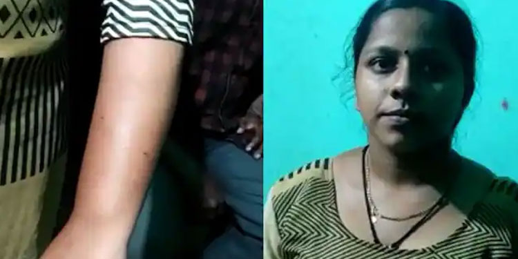 മുറിയില്‍ ഉറങ്ങുകയായിരുന്ന വിദ്യാര്‍ഥിനിയെ തെരുവ് നായ കടിച്ചു