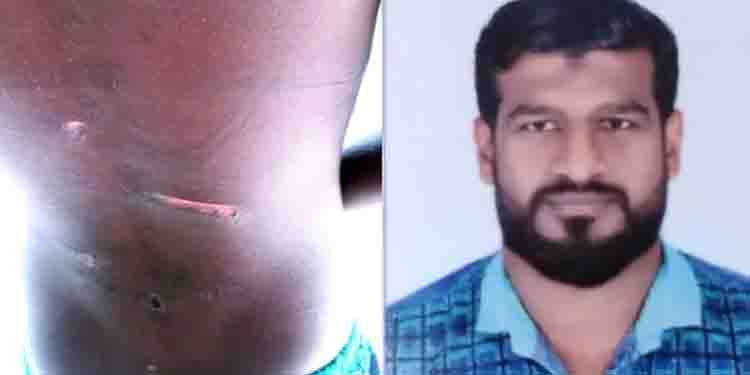 എട്ടും ഒന്‍പതും വയസുള്ള മക്കളെ പൂട്ടിയിട്ട്  കേബിളിനും ചൂരലിനും മര്‍ദ്ദിച്ച് പിതാവ്; അറസ്റ്റ്