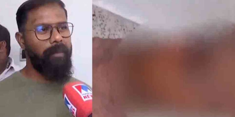 സിനിമാ ഷൂട്ടിങ്ങിനിടെ തെരുവുനായ ആക്രമണം; ക്യാമറമാന് കടിയേറ്റു