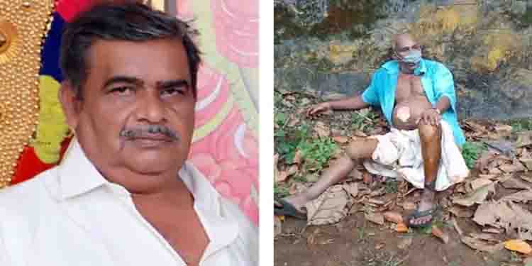 ദമ്പതികളെ തീകൊൊളുത്തി കൊന്ന സംഭവം: പൊളളലേറ്റ പ്രതിയുടെ നില അതീവ ഗുരുതരം , മൊഴിയെടുക്കാനാകാതെ പൊലീസ്
