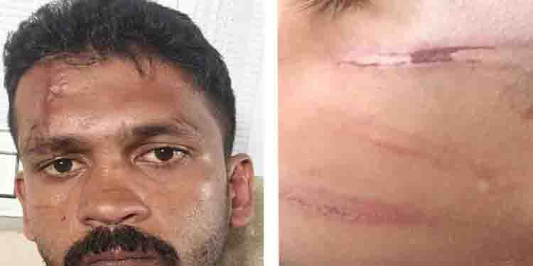 മൂന്നര വയസുള്ള കുട്ടിയെ മര്‍ദ്ദിച്ച കേസില്‍ ജാമ്യം; വീണ്ടും അതേ കുറ്റത്തിന് പ്രതി അറസ്റ്റില്‍