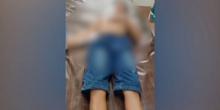കുന്നംകുളത്ത് ഭിന്നശേഷിക്കാരനായ ഒന്‍പത് വയസ്സുകാരനു നേരെ തെരുവുനായ ആക്രമണം