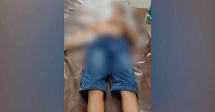 കുന്നംകുളത്ത് ഭിന്നശേഷിക്കാരനായ ഒന്‍പത് വയസ്സുകാരനു നേരെ തെരുവുനായ ആക്രമണം