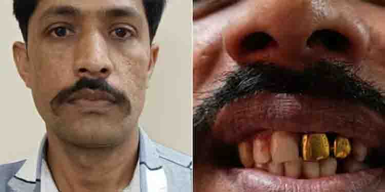 സ്വർണപ്പല്ല് ചതിച്ചു, 15 വർഷമായി പോലീസിനെ വെട്ടിച്ച് ഒളിവിൽ കഴിഞ്ഞയാൾ പിടിയിൽ