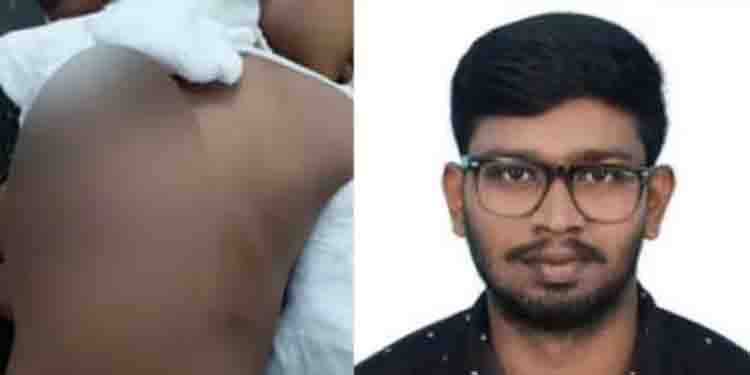 മദ്യപിച്ചെത്തി 5 വയസുകാരന്‍റെ കൈ തല്ലിയൊടിച്ചു; രണ്ടാനച്ഛന്‍ പിടിയില്‍