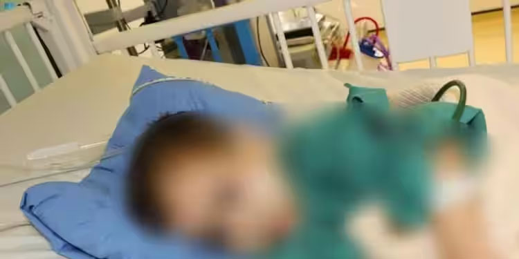 ഒരാഴ്ച മുമ്പ് വേർപെടുത്തിയ സയാമീസ് ഇരട്ടക്കുട്ടികളിൽ ഒരാൾ മരിച്ചു