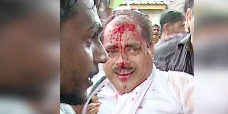 കോൺഗ്രസ് മാർച്ചിൽ സംഘർഷം; ഡി.സി.സി പ്രസിഡന്റിന്റെ തലപൊട്ടി