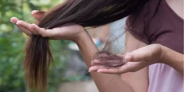 തലമുടി കൊഴിച്ചില്‍ തടയാന്‍ അഞ്ച് വഴികള്‍…