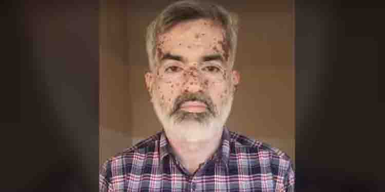 ‘30,000 ശമ്പളം, വര്‍ക്ക് ഫ്രം ഹോം’ ജോലി വാഗ്ദാനം ചെയ്ത് തട്ടിപ്പ്; 44കാരന്‍ പിടിയില്‍