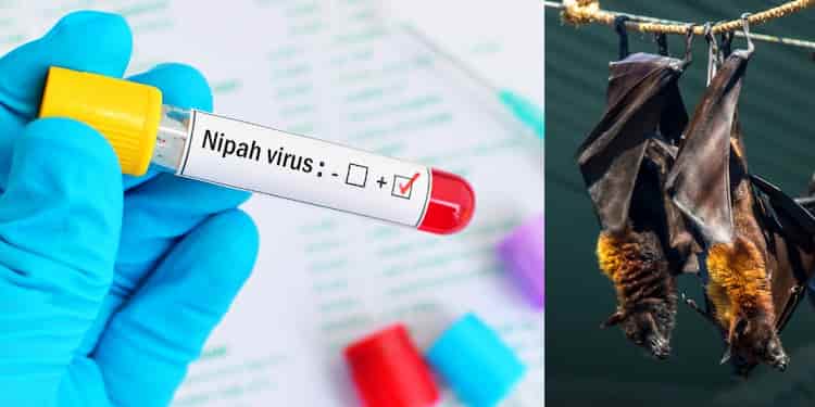 നിപ സ്ഥിരീകരിച്ച ചെറുവണ്ണൂര്‍ സ്വദേശിയുടെ റൂട്ട് മാപ്പ് പുറത്തുവിട്ടു