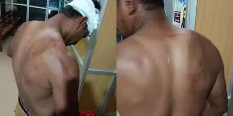 പനമരത്ത് യൂത്ത്‌ലീഗ് പ്രവര്‍ത്തകനെ വളഞ്ഞിട്ട് തല്ലി, ശരീരമാസകലം അടിയേറ്റു; പിന്നില്‍ ഡിവൈഎഫ്ഐയെന്ന് ആരോപണം
