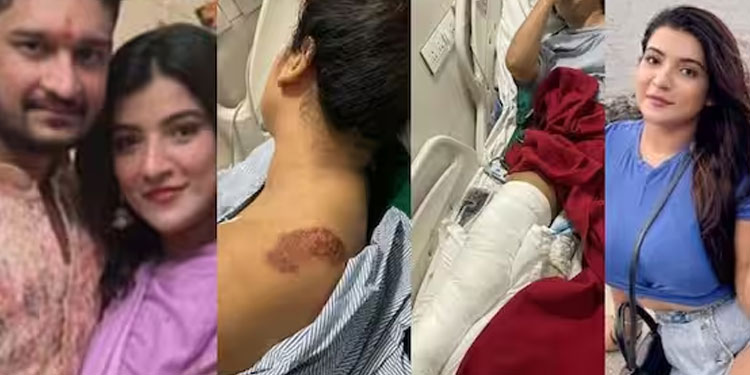 ‘ശ്വാസം മുട്ടിച്ചു, തലമുടി വലിച്ച് നിലത്തിട്ടു, കാലിൽ കാർ കയറ്റി’; കാമുകൻ ഇൻസ്റ്റ താരത്തോട് ചെയ്തത് ക്രൂരത!