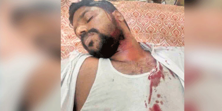 യൂത്ത് കോൺഗ്രസ്‌ പൊലീസ് സ്റ്റേഷൻ മാർച്ചിൽ സംഘർഷം