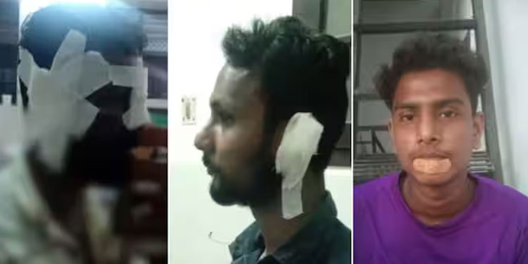 ‘ചങ്ങായീസ് തട്ടുകട’യിൽ യുവാക്കളുടെ അക്രമം; ഉടമയുടെ തല തല്ലിപ്പൊളിച്ചു, ജീവനക്കാർക്കും മർദ്ദനം