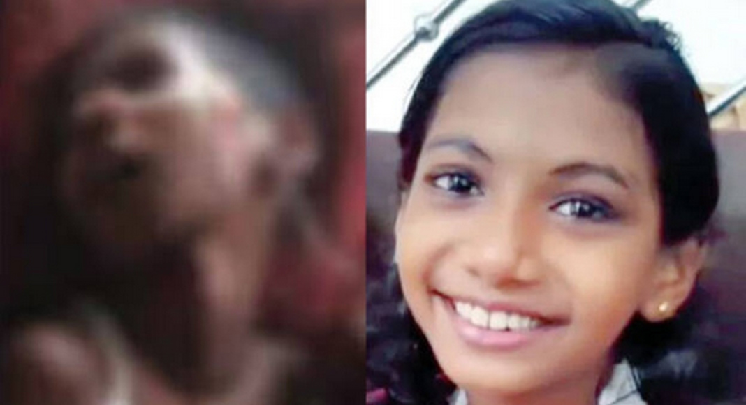 വടകരയില്‍ കാർ ഇടിച്ച് നിർത്താതെ പോയ സംഭവത്തിൽ കോമയിൽ ആയ ഒമ്പത് വയസുകാരി ദൃഷാന ആശുപത്രി വിട്ടു