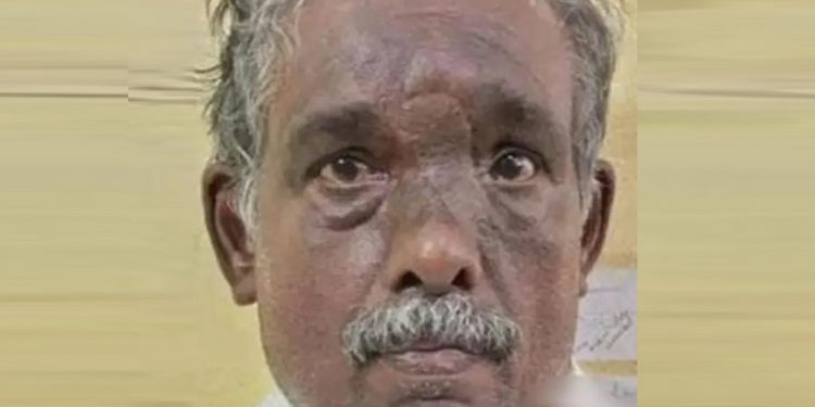 വനിതാ കൗണ്‍സിലറുടെ ബാഗ് മോഷ്ടിച്ചുകടന്ന സംഭവത്തില്‍ പ്രതി അറസ്റ്റില്‍