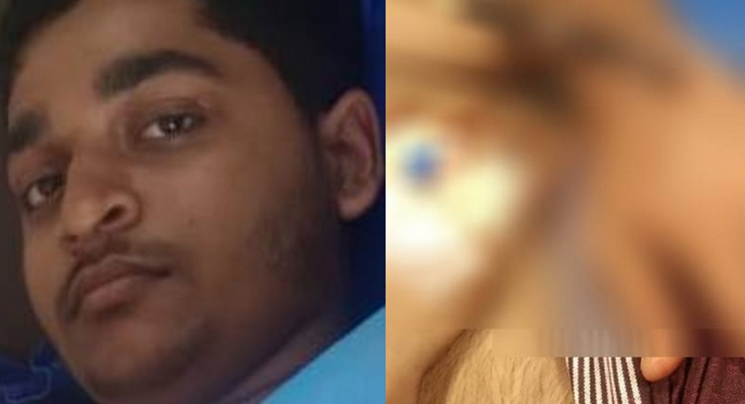 കൂത്തുപറമ്പ് കണ്ടേരിയിൽ മുള്ളൻ പന്നിയുടെ ആക്രമണത്തിൽ പ്ലസ് വൺ വിദ്യാർത്ഥിക്ക് പരിക്ക്